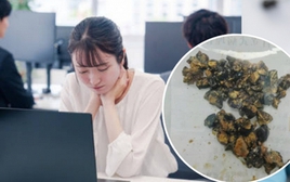 Nữ nhân viên văn phòng 35 tuổi cấp cứu vì đau bụng dữ dội, bác sĩ phát hiện túi mật vỡ, rơi ra 60 viên...