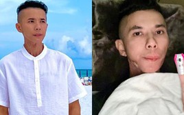 Những ngày cuối đời của ca sĩ Kasim Hoàng Vũ: Khuôn mặt biến dạng do bệnh u xương hàm, bế tắc vì chi phí chữa trị hàng tỷ đồng