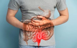 Số liệu mới đáng báo động về ung thư đại trực tràng: Người trẻ bị "nhắc tên"