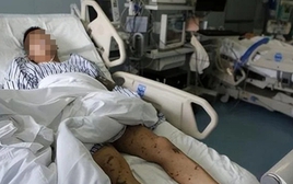 Người đàn ông suy thận vì mắc 1 sai lầm khi làm "chuyện ấy"