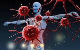 7 thay đổi bất ngờ trên cơ thể: Rất có thể ung thư đã tìm tới bạn!