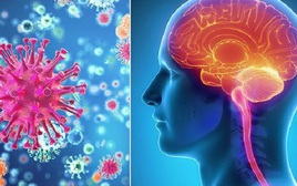 Kết quả xét nghiệm 3 trường hợp nghi viêm não mô cầu ở Cà Mau