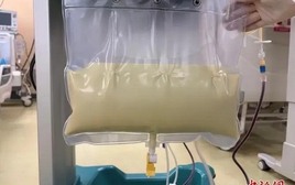 Sản phụ mang song thai gặp tình trạng “máu như sữa” nguy kịch