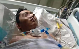 Ngày càng có nhiều người tử vong vì ung thư vòm họng, bác sĩ nhắc nhở: Đừng làm 4 việc vào buổi sáng!