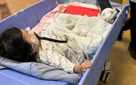 Bé gái 1 tuổi suýt chết khi ăn hạt hướng dương, bác sĩ cảnh báo đến những gia đình có trẻ dưới 3 tuổi