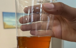 Ngày càng có nhiều người tử vong vì ung thư tuyến tụy, bác sĩ nhắc: Đừng xem nhẹ 3 thứ khi đi vệ sinh!