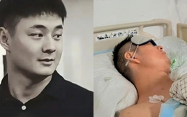 Chàng trai ung thư qua đời ở tuổi 24 vì bỏ qua cảnh báo từ 1 nốt ruồi