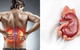 Nghiên cứu trên 417 người chỉ ra 5 ĐIỂM chung của người suy thận: Nhiều thói quen người Việt vẫn vô tình làm mỗi ngày