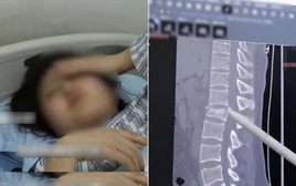 Dùng điện thoại khi làm 1 việc, cô gái có thể liệt 2 chân, tiểu không tự chủ suốt đời