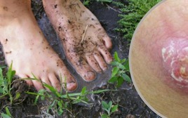 Hiểu đúng về bệnh do "vi khuẩn ăn thịt người"