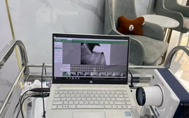 Vạch chiêu moi tiền làm răng sứ: Tiền mất tật mang