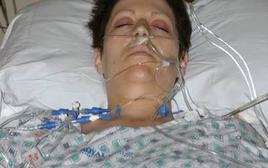 Người phụ nữ 36 tuổi chỉ còn sống được 15 tháng vì hồi nhỏ thích mặc áo của bố