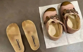 Mẹ đăng bài "cầu cứu" vì con gái 10 tuổi bị hôi chân nặng, cư dân mạng gợi ý 1 câu khiến chị sững sờ!