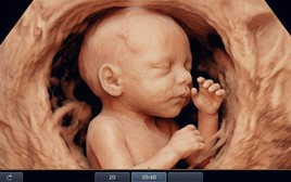 Bác sĩ nghẹn lòng trước mong muốn của sản phụ: "Bác… cố chụp cho con em một tấm ảnh thật đẹp… để làm kỷ niệm"