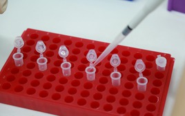 Mang mẫu tóc con trai đi xét nghiệm ADN: Chưa kịp vui đã phải sốc nặng vì điều này