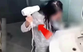 Sấy tóc sau khi gội đầu, cô gái bỏng thâm đen bàn tay: Thói quen ai cũng đã từng mắc phải