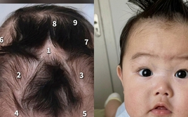 Em bé gây chú ý vì có tới 9 xoáy tóc trên đầu: Liệu có điều gì đặc biệt liên quan đến não bộ của bé?