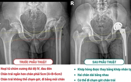 Khách Tây là kỹ sư vượt 10.000km sang 1 bệnh viện ở Việt Nam phẫu thuật: "Trước đây tôi chưa từng nghĩ có ngày gót chân chạm đất"
