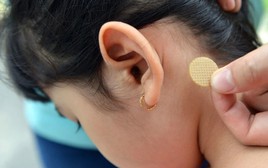 Bé gái 7 tuổi loạn thần, sốt cao sau khi sử dụng miếng dán chống say tàu xe: Bác sĩ cảnh báo sai lầm nguy hiểm bố mẹ mắc phải