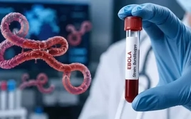 Bộ Y tế kích hoạt giám sát dich Ebola, tăng cường ngăn dịch xâm nhập