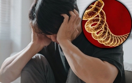 Người đàn ông 44 tuổi đột nhiên thay đổi tính cách và hay nói tục, bác sĩ thở dài: Nó đã "ăn" tới não