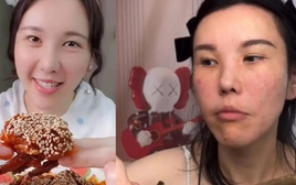 Mặt cô gái trẻ biến dạng sau 2 năm làm mukbang, bác sĩ cảnh báo 4 cái giá phải trả về sức khỏe ít ai biết đến