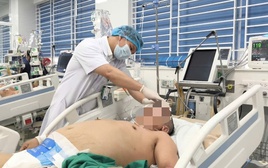 Tưởng mình khỏe mạnh, người đàn ông 45 tuổi xuất huyết não nguy kịch sau trận nhậu
