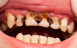 Trẻ thiếu canxi thường phát ra 5 tín hiệu: Bệnh viện Nhi đồng 2 cảnh báo đừng chủ quan