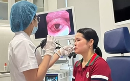 Tưởng vô hại, thuốc xịt mũi dùng kéo dài có thể gây nhiều tổn thương