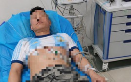 Tiktoker được mệnh danh "thần rượu" tử vong vì suy đa tạng, bác sĩ thở dài: Kết cục khó tránh!