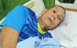 Người đàn ông suýt chết vì viêm màng não sau khi ăn 1 loại thịt rất quen: Bác sĩ khuyên mở tủ lạnh nhà bạn kiểm tra ngay!