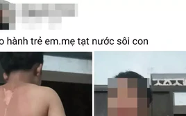 Công an vào cuộc vụ bé trai ở Đắk Lắk nghi bị mẹ tạt nước sôi