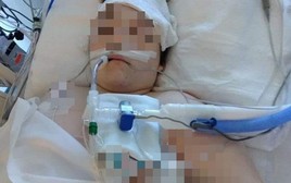 Cô gái 26 tuổi tử vong vì ung thư phổi, từng lên mạng cảnh báo 4 dấu hiệu tuyệt đối không được bỏ qua!