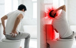 Bác sĩ cảnh báo 1 hành động khi đại tiện dễ gây đột quỵ: Hiếm ai chưa từng làm trong đời