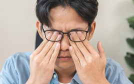 Choáng: Người đàn ông có hàng nghìn con rận ở mi mắt, bác sĩ chỉ ra nguyên nhân nhiều người mắc phải
