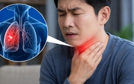 Bác sĩ cảnh báo: 3 BIỂU HIỆN ở cổ họng có thể là “tín hiệu sớm” của VIÊM PHỔI, nếu bỏ qua có thể trở nặng