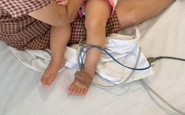Mẹ chia sẻ bài học xương máu khi con bị sốc phản vệ khi truyền dịch: "Không ngờ mạng sống của con có lúc chỉ còn tính bằng phút"