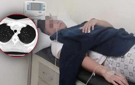 Nam thanh niên tuổi 20 phổi trắng xóa, suy đa tạng: Nguyên nhân xuất phát từ… ruộng lúa