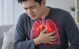 Bác sĩ BV Bạch Mai chỉ: 4 nguy cơ gây ung thư phổi ở người không hút thuốc, nhiều người vô tình tiếp xúc mỗi ngày mà không hay biết
