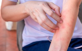 Nếu bạn có hai vùng da bị ngứa dai dẳng trên cơ thể, hãy cảnh giác vì đó có thể là dấu hiệu của ung thư gan