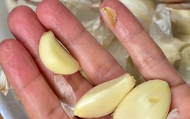 Ăn tỏi mỗi ngày để chữa viêm thận, 5 tháng sau chàng trai 28 tuổi khiến bác sĩ phải thốt lên khi khám: “Anh đã ăn gì?”