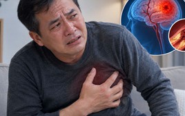 Nghiên cứu theo dõi 20 năm chỉ ra 3 ĐIỂM CHUNG ở những người có nguy cơ mắc bệnh tim mạch và đột quỵ