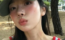 Lời khuyên cho những ai mọc nốt ruồi ở 6 nơi trên cơ thể: Coi chừng ung thư!
