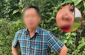 Vụ cô gái tố tài xế ô tô hành hung chảy máu mồm: Người đánh là cán bộ xã