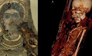Máy quét CT phát hiện sự thật rùng rợn bên trong bức tượng dát vàng