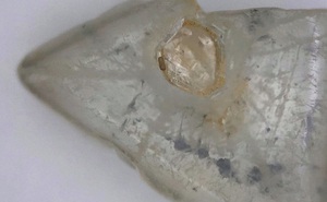Công ty khai thác vớ bẫm vì đào được viên kim cương lồng trong kim cương độc nhất vô nhị