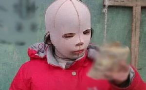 Bé gái 10 tuổi đeo mặt nạ suốt 4 năm được cha đưa lên truyền hình, lúc gỡ ai cũng bật khóc