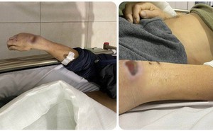 Hai cựu công an dùng nhục hình thế nào khiến người bị tạm giam tử vong?