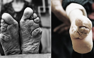 Những đôi chân gót sen cuối cùng tại Trung Quốc: Nhân chứng sống ám ảnh về hủ tục kinh dị
