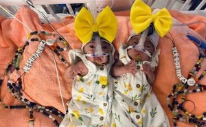 Hi hữu: Cặp sinh đôi ra đời cách nhau 3 ngày